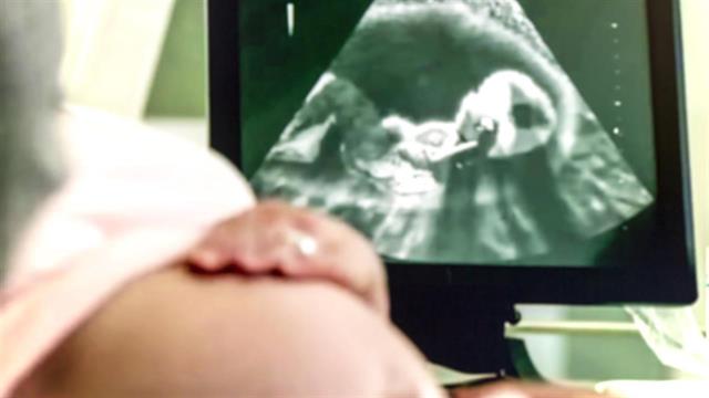 Καρδιολογικά προβλήματα στα έμβρυα: Ανίχνευση και αντιμετώπιση