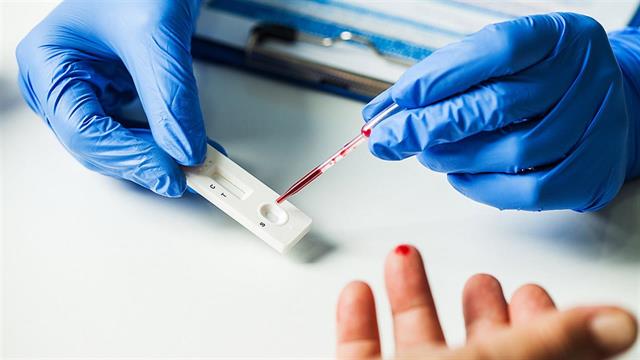 Το Συντονιστικό Όργανο της ΠΦΥ ζητά την απόσυρση των ρυθμίσεων που αφορούν το Claw back και τη διενέργεια Rapid Τest από μη ιατρούς