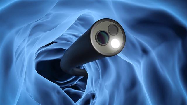 Κολονοσκόπηση με Τεχνητή Νοημοσύνη