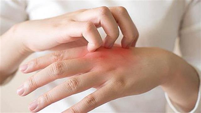 Πώς αντιδρά το δέρμα στις υψηλές θερμοκρασίες;