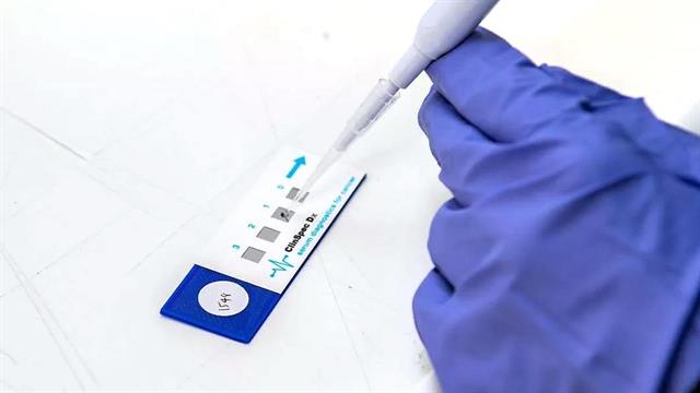 Καινοτόμο τεστ εντοπίζει έγκαιρα τον καρκίνο στον εγκέφαλο