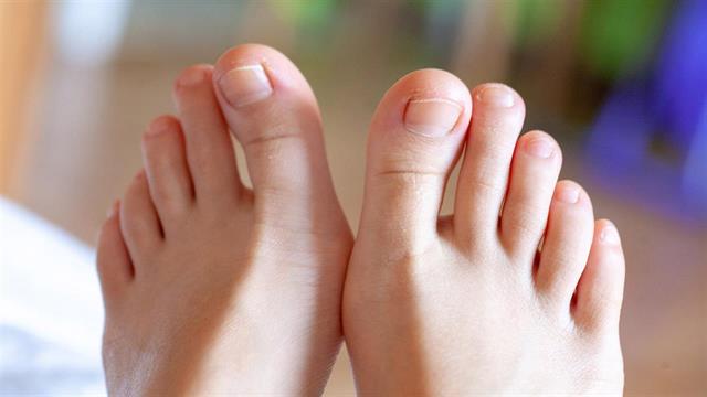 Ονυχομυκητίαση: Ένα μικρό πρόβλημα με μεγάλο χρόνο θεραπείας