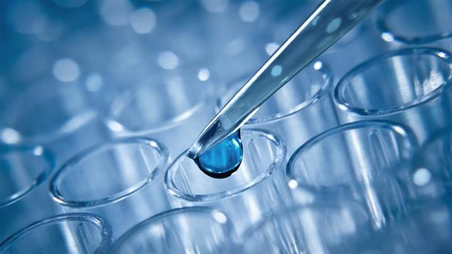 Παρέμβαση ΠΙΣ για την κοστολόγηση των τεστ