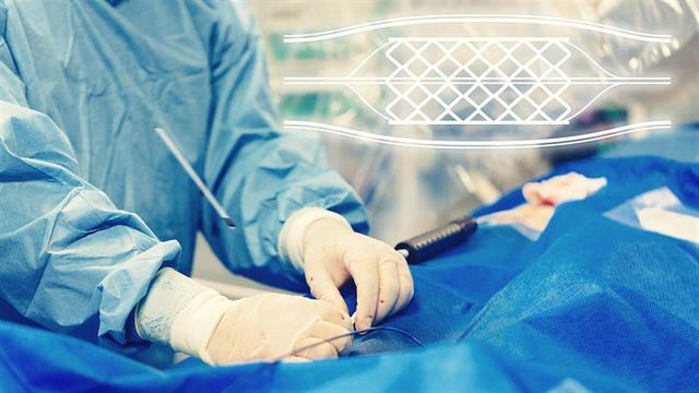 Αγγειοπλαστική: η πρώτη επιλογή για ασθενείς με στεφανιαία νόσο και οξύ έμφραγμα