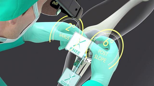 Αρθροπλαστική γόνατος με σύγχρονο σύστημα ‘’επαυξημένης πραγματικότητας’’