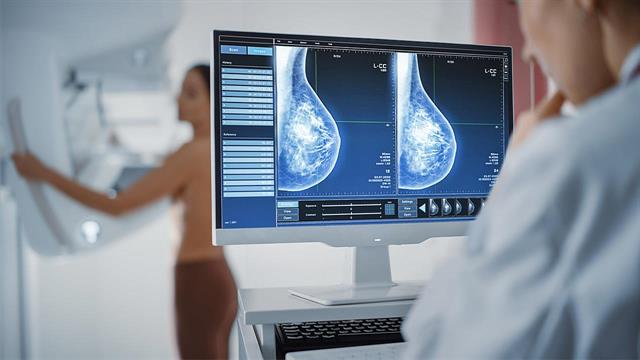 Ο ΠΙΣ καλεί όλες τις γυναίκες να κάνουν ανελλιπώς ετησίως μαστογραφία