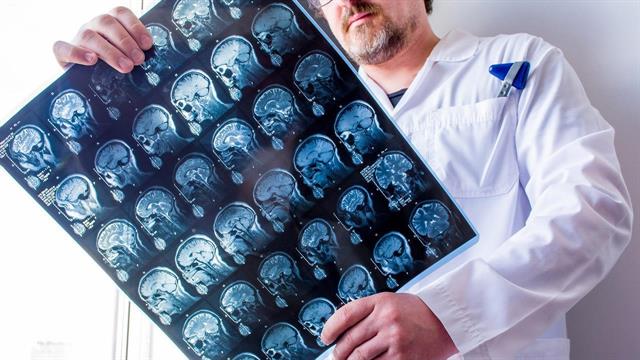 ΕΥΔΑΠ: Δωρεά συστήματος αξονικού τομογράφου στο ΓΝΝΘΑ ‘’Η ΣΩΤΗΡΙΑ’’