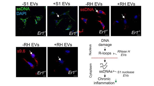 Βλάβες στο DNA προκαλούν χρόνια φλεγμονή και παγκρεατίτιδα