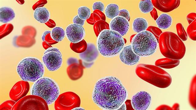 Ανακαλύφτηκαν γενετικές μεταλλάξεις που προδιαθέτουν στην οξεία μυελοειδή λευχαιμία