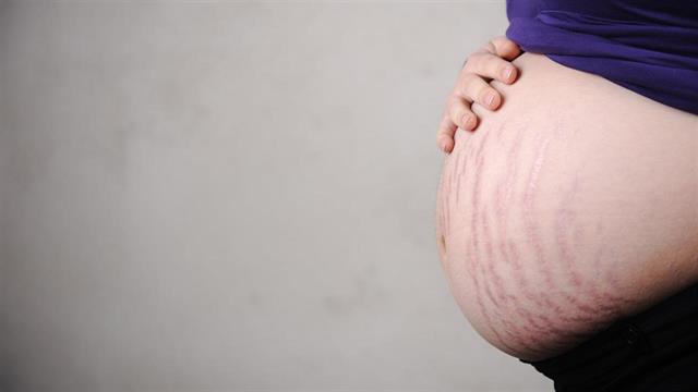 Πώς επηρεάζει το δέρμα η εγκυμοσύνη;