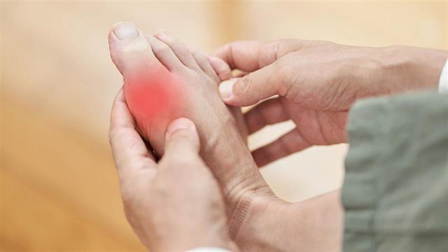 Ουρική αρθρίτιδα: Υπάρχουν τροφές που την επηρεάζουν;