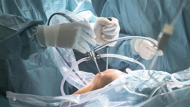 Αρθροσκόπηση: Ελάχιστα επεμβατική θεραπεία των παθήσεων των αρθρώσεων