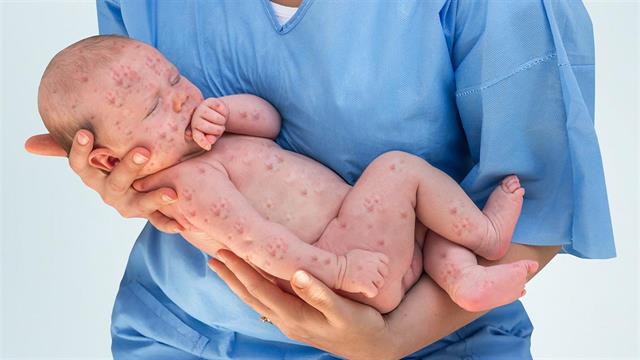 Παθήσεις που σχεδόν εξαφανίστηκαν λόγω εμβολίων