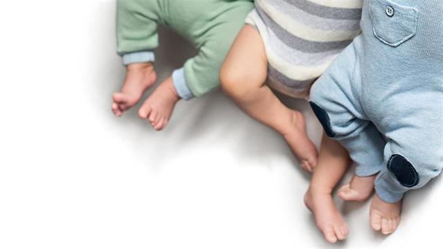 Γεννήθηκαν τρίδυμα κοριτσάκια από τον ίδιο πλακούντα
