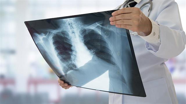 ΕΟΔΥ: Παγκόσμια Ημέρα Φυματίωσης 2022