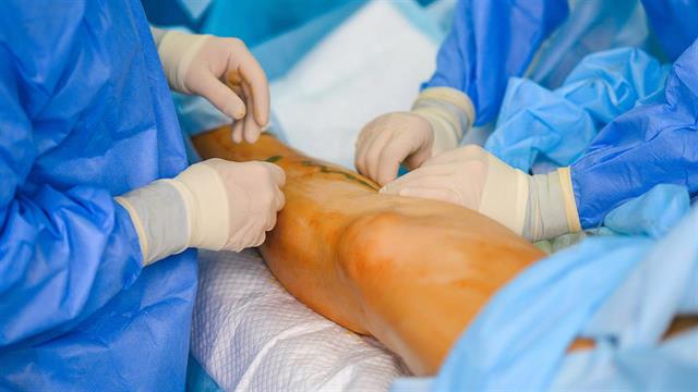 Αγγειακές παθήσεις: Η πρόληψη και ο ρόλος της αγγειοχειρουργικής