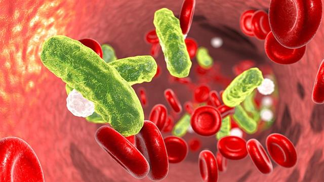 Νέα εξέταση εντοπίζει τη σήψη λίγο μετά τη λοίμωξη