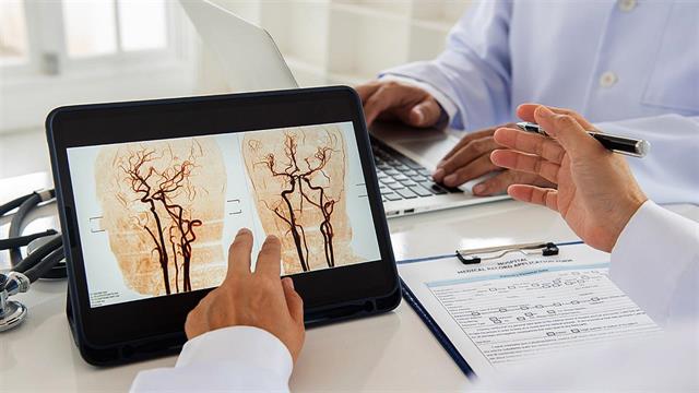 Ενδοαγγειακή νευροχειρουργική για αντιμετώπιση βλαβών του εγκεφάλου