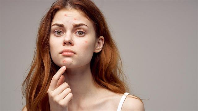 Διαβήτης: Τα προειδοποιητικά σημάδια στο δέρμα