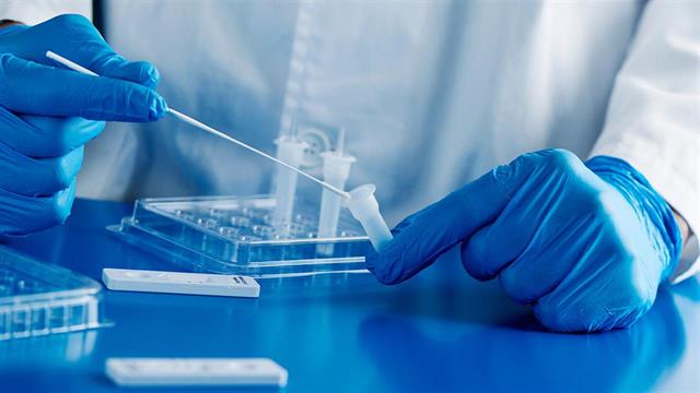 ECDC: Τα rapid tests αλλάζουν την Ιατρική - Ο ρόλος τους στην CoViD και σε μία σειρά από παθήσεις