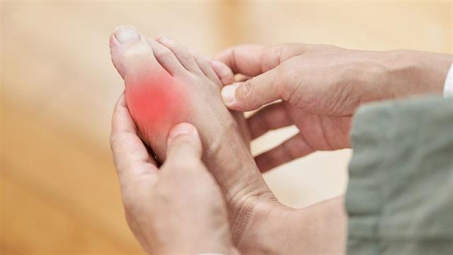 Ουρική αρθρίτιδα: Συμπτώματα, διάγνωση και θεραπεία