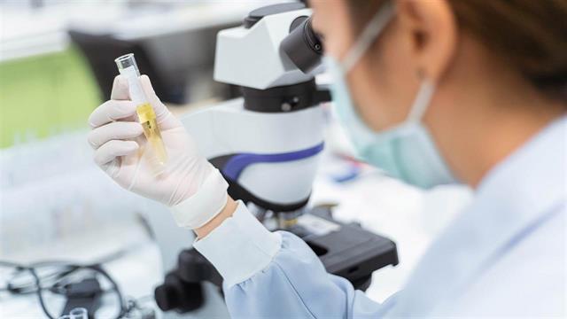 Νέο τεστ ανιχνεύει αντισώματα Covid-19 στα ούρα