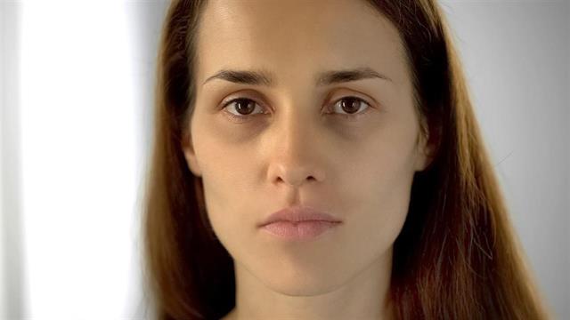 Μαύροι κύκλοι στα μάτια: Πότε χρειάζονται διερεύνηση