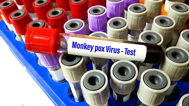 Ευλογιά πιθήκων: Αποχή από το σεξ συστήνει στους ασθενείς η Βρετανία