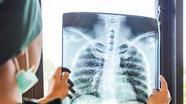 Εξελίξεις για την κυστική ίνωση ανακοινώθηκαν στο 45ο Ευρωπαϊκό Συνέδριο