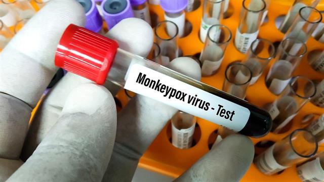 Η κυβέρνηση Μπάιντεν αυξάνει τη διαθεσιμότητα τεστ για την ευλογιά των πιθήκων