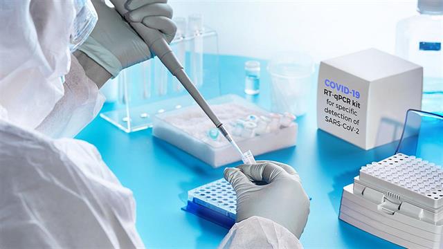 ΕΟΔΥ: Κάθε Παρασκευή εφεξής το επιδημιολογικό δελτίο για την CoViD - 19