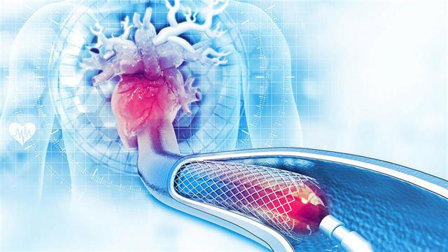 Σύμπλοκες Αγγειοπλαστικές στεφανιαίων αρτηριών