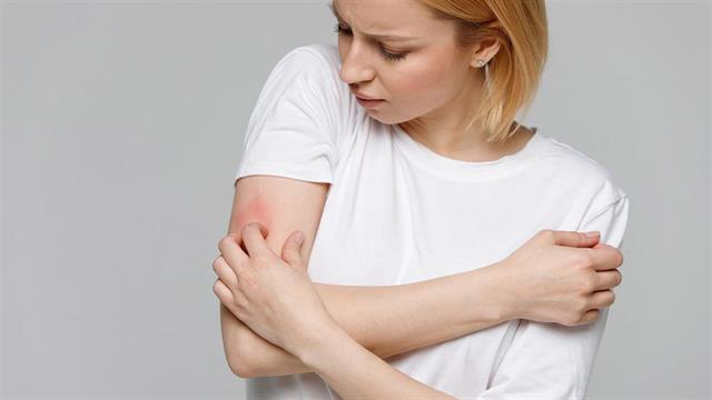 Υποσχόμενη νέα μέθοδος για την αντιμετώπιση της ατοπικής δερματίτιδας