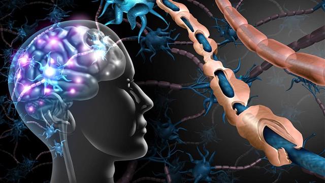 Σκλήρυνση κατά πλάκας: Το αντίσωμα CD20 Ublituximab αποφεύγει τις εξάρσεις και εμποδίζει νέες βλάβες