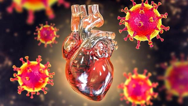 Long CoViD:  Ελαφράς μορφής μυοκαρδίτιδα ακόμη και μετά από ήπια νόσηση