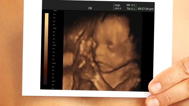 Οι πρώτες ενδείξεις ότι τα έμβρυα μπορούν να μυρίζουν και να γεύονται