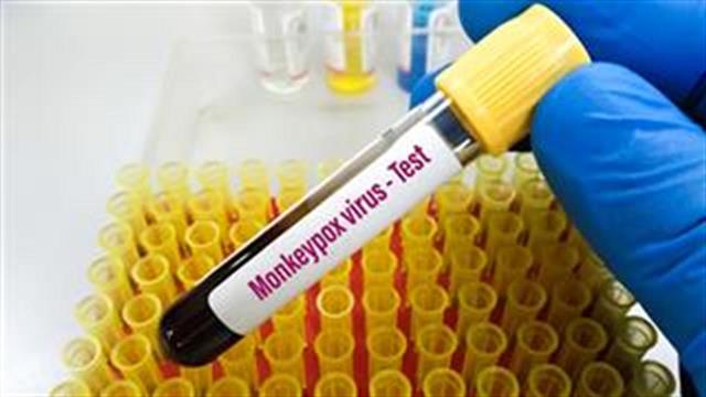 Στα 82 ανέρχονται τα κρούσματα ευλογιάς των πιθήκων στη χώρα μας- Αυξήθηκαν κατά 2 την τελευταία εβδομάδα