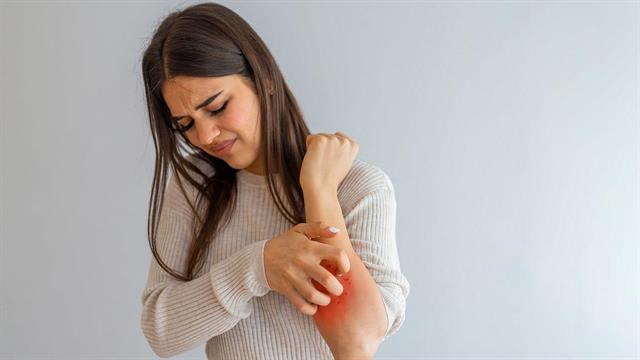 Έγκριση του dupilumab από τον FDA για την οζώδη κνήφη