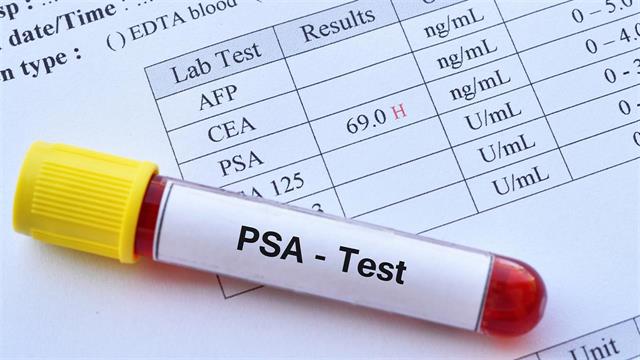 Προστάτης: Απαραίτητη η εξέταση PSA σε όλους τους άνδρες