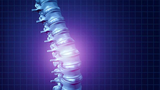 Ρομποτική χειρουργική σπονδυλικής στήλης