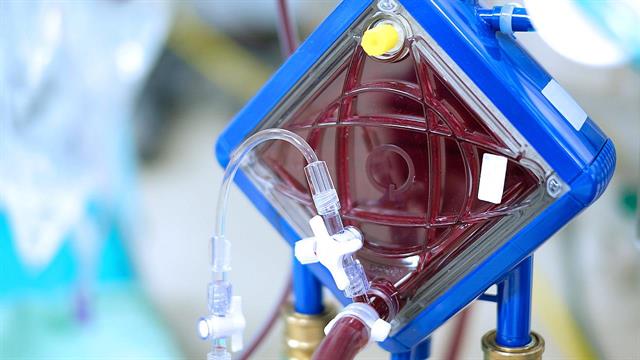 Εξειδικευμένο Σεμινάριο ECMO/LVAD στην Αθήνα
