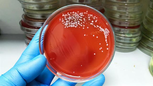 ΕΟΔΥ: Τι πρέπει να γνωρίζουμε για τον στρεπτόκοκκο Α - Προστασία των παιδιών