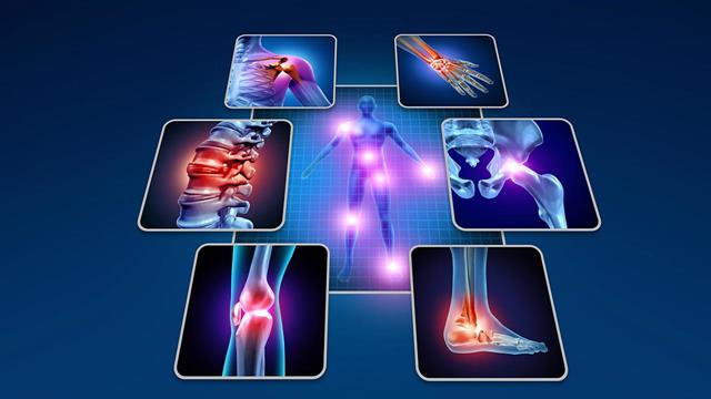 Ρευματισμοί: γονίδια, κάπνισμα και επαγγελματικοί ατμοσφαιρικοί ρύποι  ως παράγοντες κινδύνου [μελέτη]