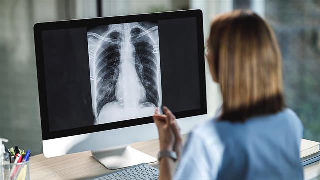 Ο FDA ενέκρινε φάρμακο κατά του καρκίνου στον πνεύμονα