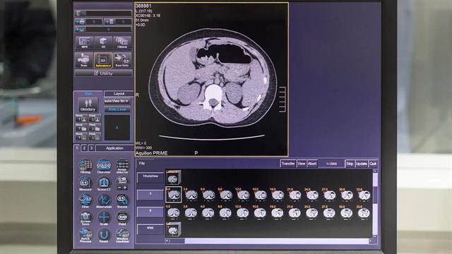 Πώς θα γίνονται οι δωρεάν προληπτικοί καρδιολογικοί έλεγχοι [τροπολογία]