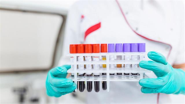 Η Ιαπωνία ενέκρινε kit εξέτασης αίματος για διάγνωση του Alzheimer