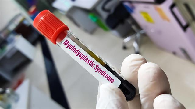 Θετικά νέα από δοκιμή τελικού σταδίου για φάρμακο κατά του καρκίνου στο αίμα