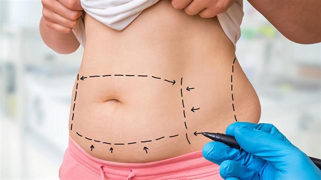 Κοιλιοπλαστική: Πώς βελτιώνει την ποιότητα ζωής;