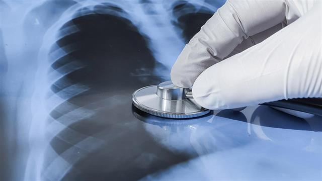 Μειώνονται τα κρούσματα φυματίωσης στη Γερμανία