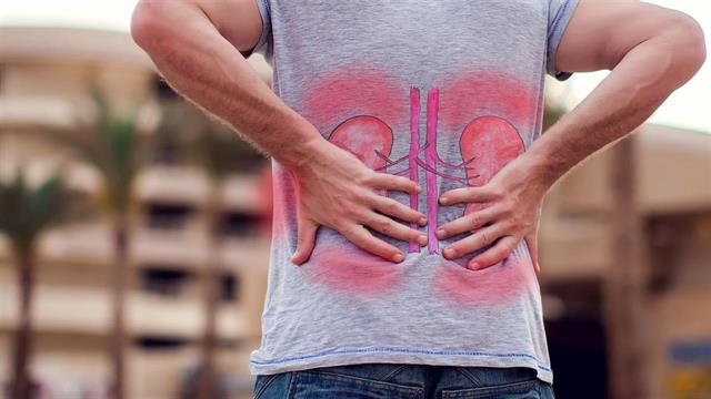 Πέτρες στα νεφρά: Τα πιο συχνά συμπτώματα